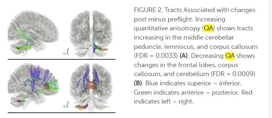 Sensorimotor tracts associated with changes post minus preflight.
